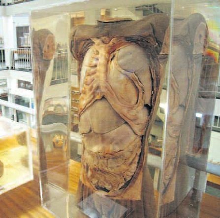 Medical Morphology Museum, Cape Town Museums, Cape Town